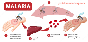 Faktor Resiko yang Terjadi Pada Penderita Penyakit Malaria